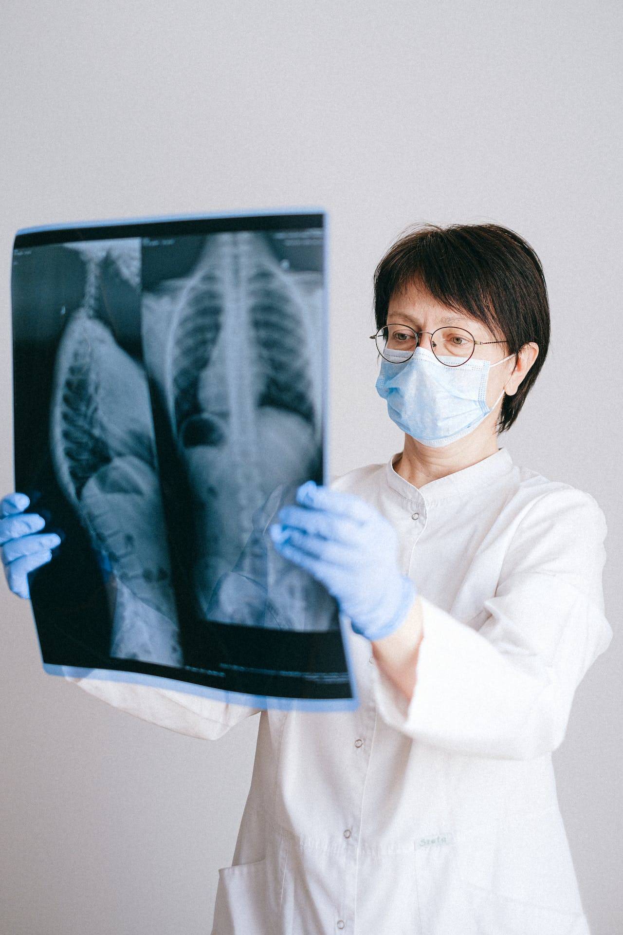 a Doctor Reviewing X-Rays, Representing the Importance of Product Manuals Written by Technical Writers for Hospitals